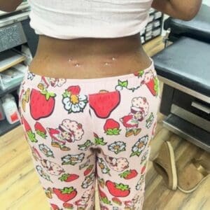 Back Surface Bars