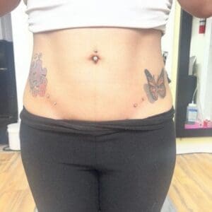 Hip Surface Bars