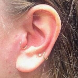 Mid-Ear Tragus