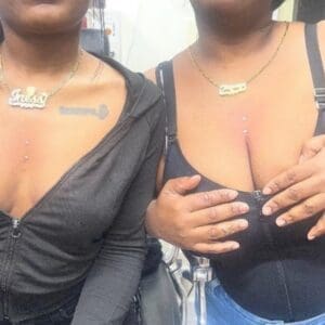 Sternum Surface Bars